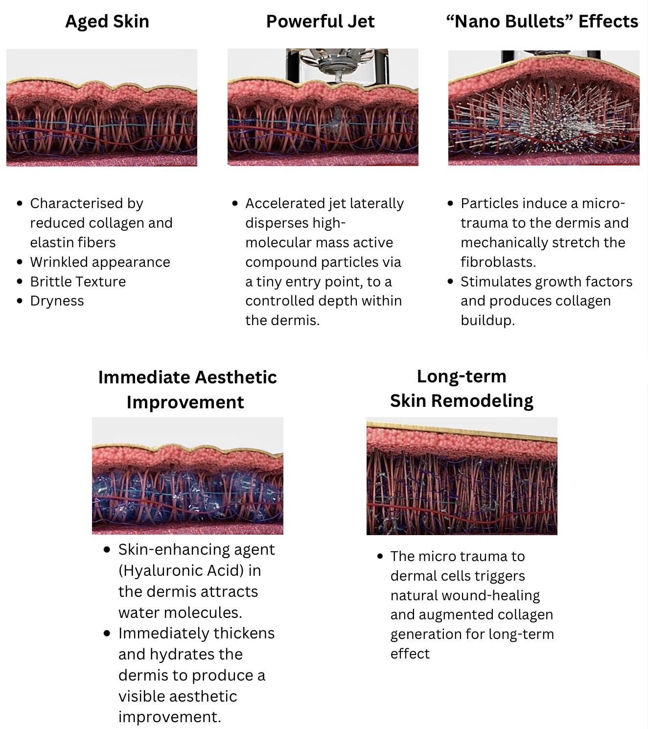 EnerJet - Alaxis Medical & Aesthetic Surgery