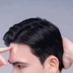 Alaxis Hair Transplant