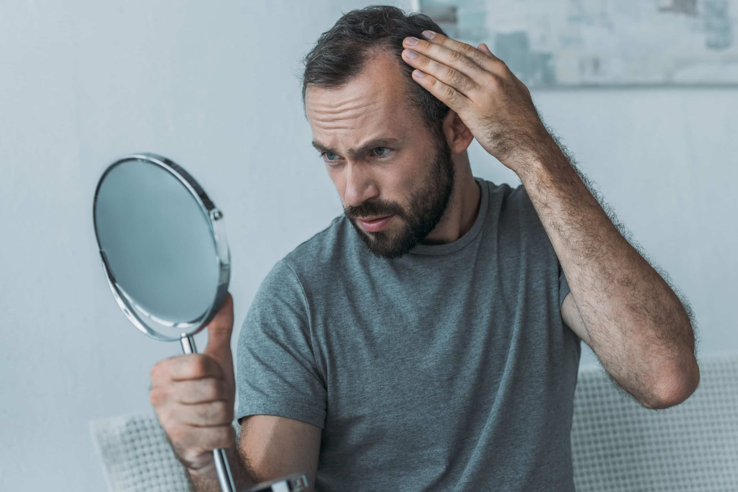 Non-Invasive Treatments to Combat Male Hair Loss