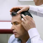 Doctor recommends Hair Transplant