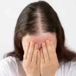 Woman suffering from Hair Loss