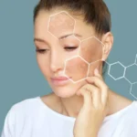 Laser Skin Pigmentation