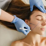 Fat Grafting to the Face